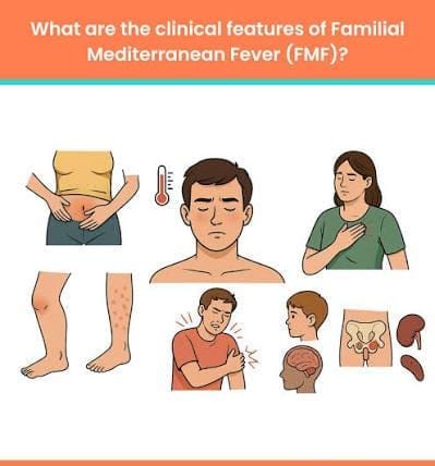 حمى البحر المتوسط