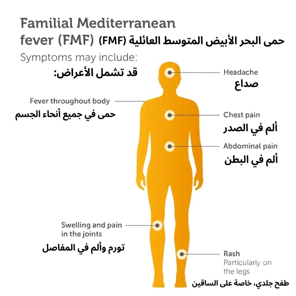 حمى البحر المتوسط